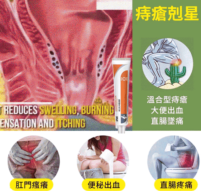 【三天「痔」好】痔立克冷敷凝膠，内痔，外痔一抹搞定，祛痣很輕鬆